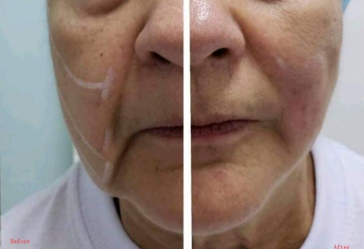 Before & After Before & After