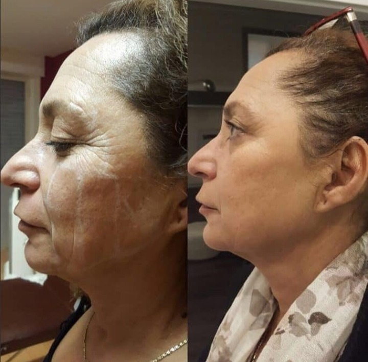 Before & After Before & After