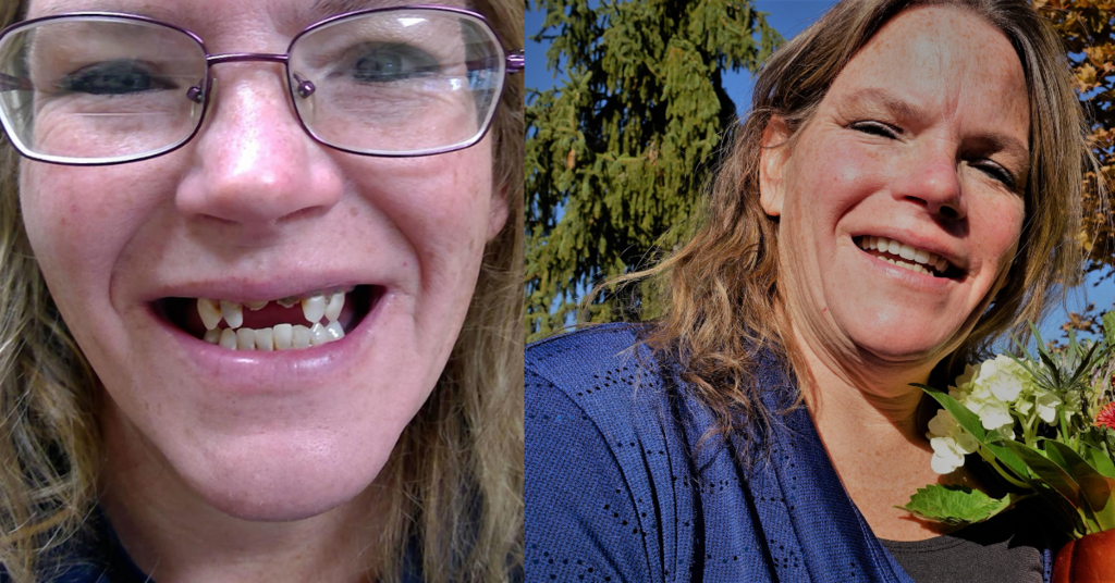 1st Class Dentures LLC Denture Care Center in Boise, ID