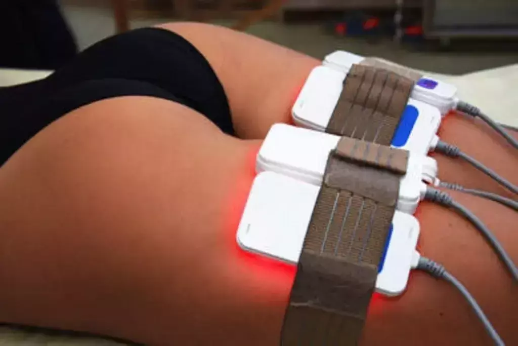 Lipo Laser Back of Thighs