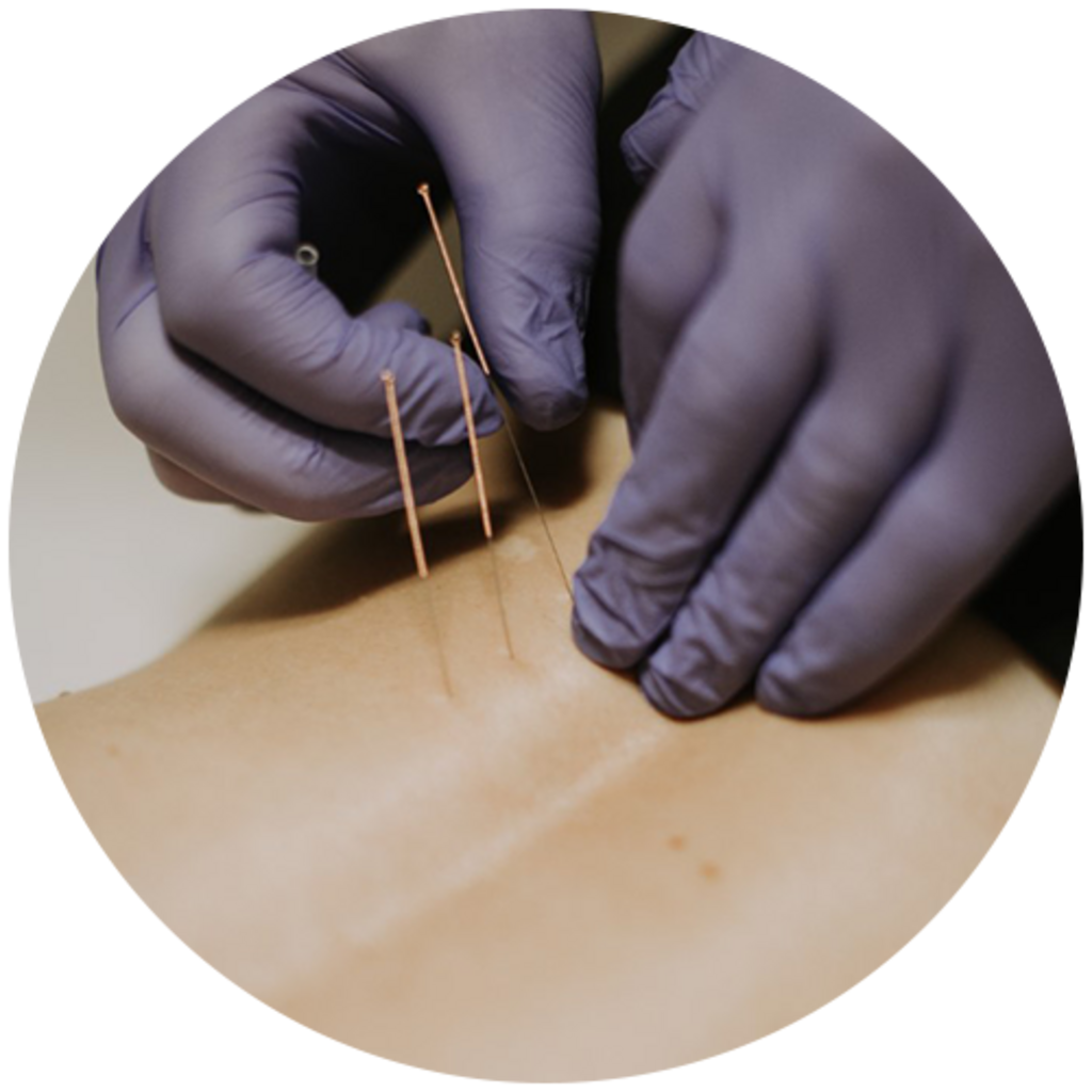 Revive PT Cryo Recovery Physical Therapist in Lehi, UT